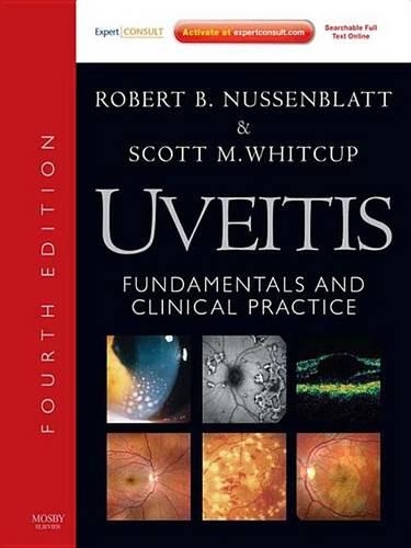 Uveitis E-Book
