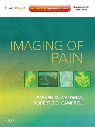Imaging of Pain E-Book