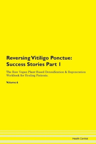 Reversing Vitiligo Ponctue