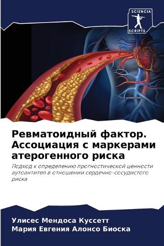 Ревматоидный фактор. Ассоциация с маркера