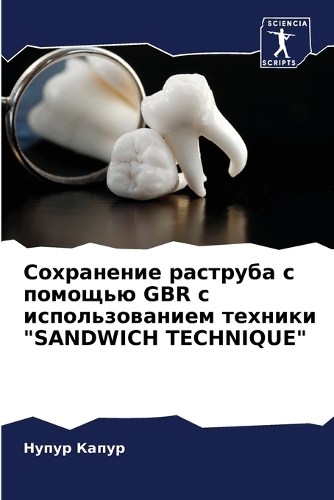Сохранение раструба с помощью GBR с использо&#