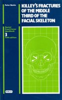 Fractures of the Middle Third of the Facial Skeleton (Dental Practical Handbooks)
