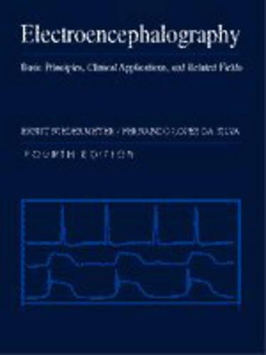 Electroencephalography