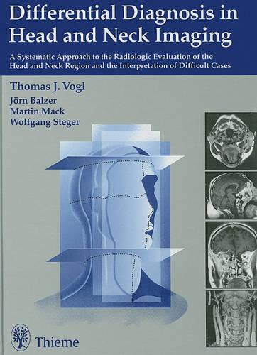 Differential Diagnosis in Head and Neck Imaging