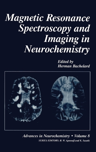 Magnetic Resonance Spectroscopy and Imaging in Neurochemistry