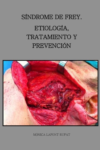 Sindrome Defrey. Etiologia, Tratamiento Y Prevencion