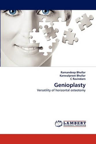 Genioplasty