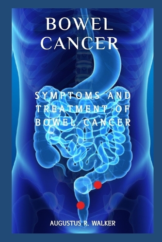 Bowel Cancer
