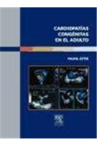 Cardiopatías Congénitas En El Adulto