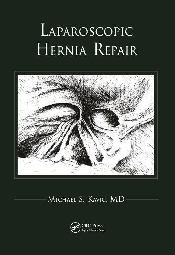 Laparoscopic Hernia Repair
