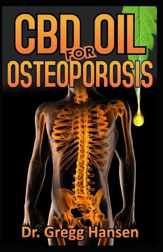 CBD Oil for Osteoporosis