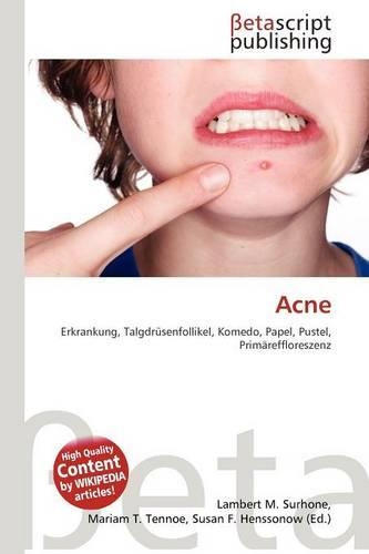 Acne