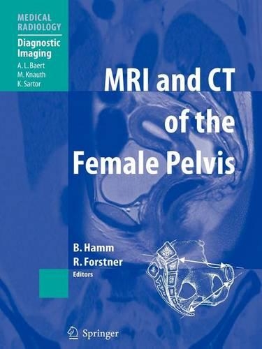 MRI and CT of the Female Pelvis
