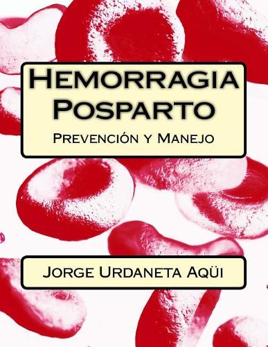 Hemorragia posparto