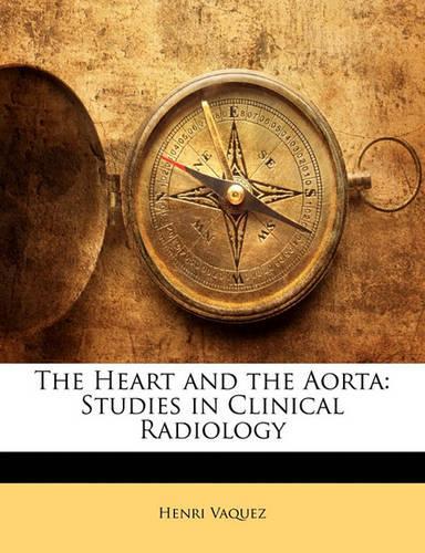 The Heart and the Aorta