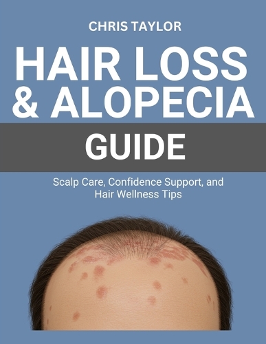 Hair Loss & Alopecia Guide