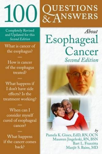 100 Questions & Answers About Esophageal Cancer