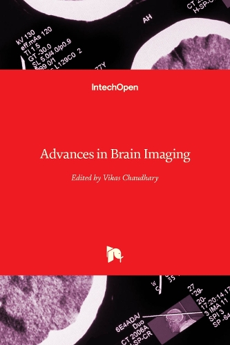 Advances in Brain Imaging