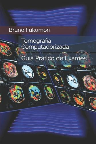 Tomografia Computadorizada: Guia Pratico De Exames