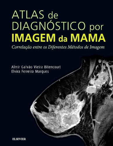 Atlas de Diagnóstico Por Imagem de Mama