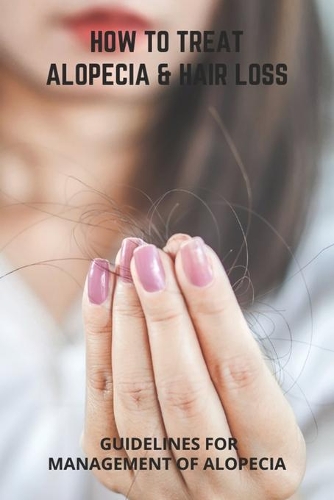 How To Treat Alopecia & Hair Loss