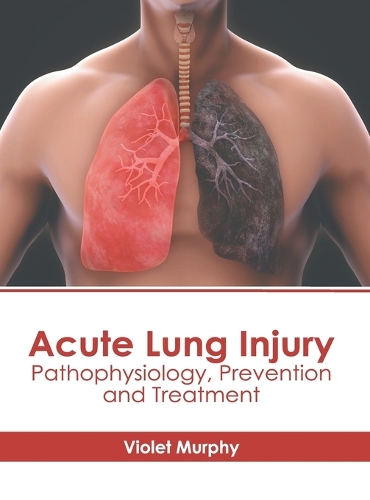 Acute Lung Injury: Pathophysiology, Prevention and Treatment