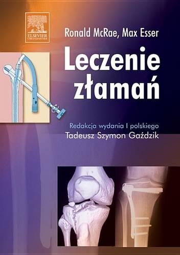 Leczenie Zlamań