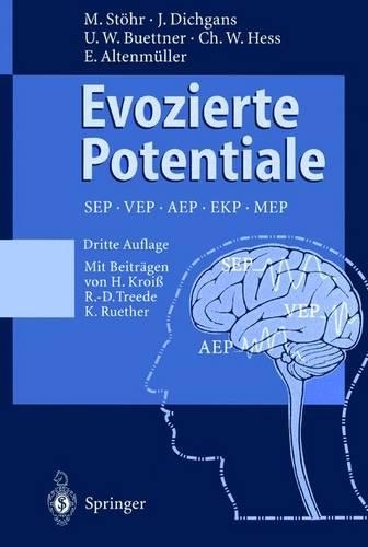 Evozierte Potentiale