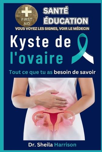 Kyste de l'ovaire
