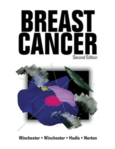 Breast Cancer