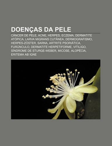 Doencas Da Pele