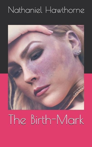 The Birth-Mark