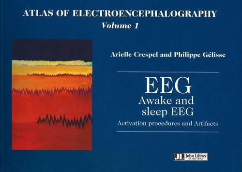 Atlas of Electroencephalography