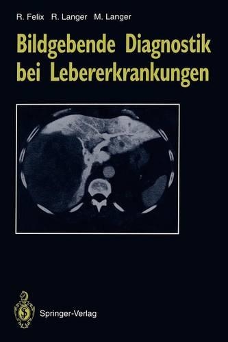 Bildgebende Diagnostik bei Lebererkrankungen