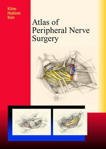 Atlas of Peripheral Nerve Surgery