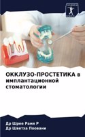 ОККЛУЗО-ПРОСТЕТИКА в имплантационной сто