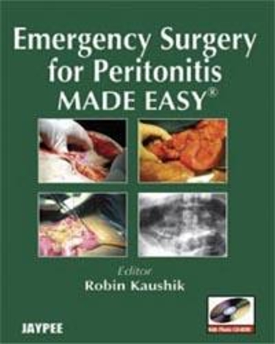 Emergency Surgery for Peritonitis Made Easy