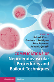 Complications of Neuroendovascular Procedures and Bailout Techniques: (English)