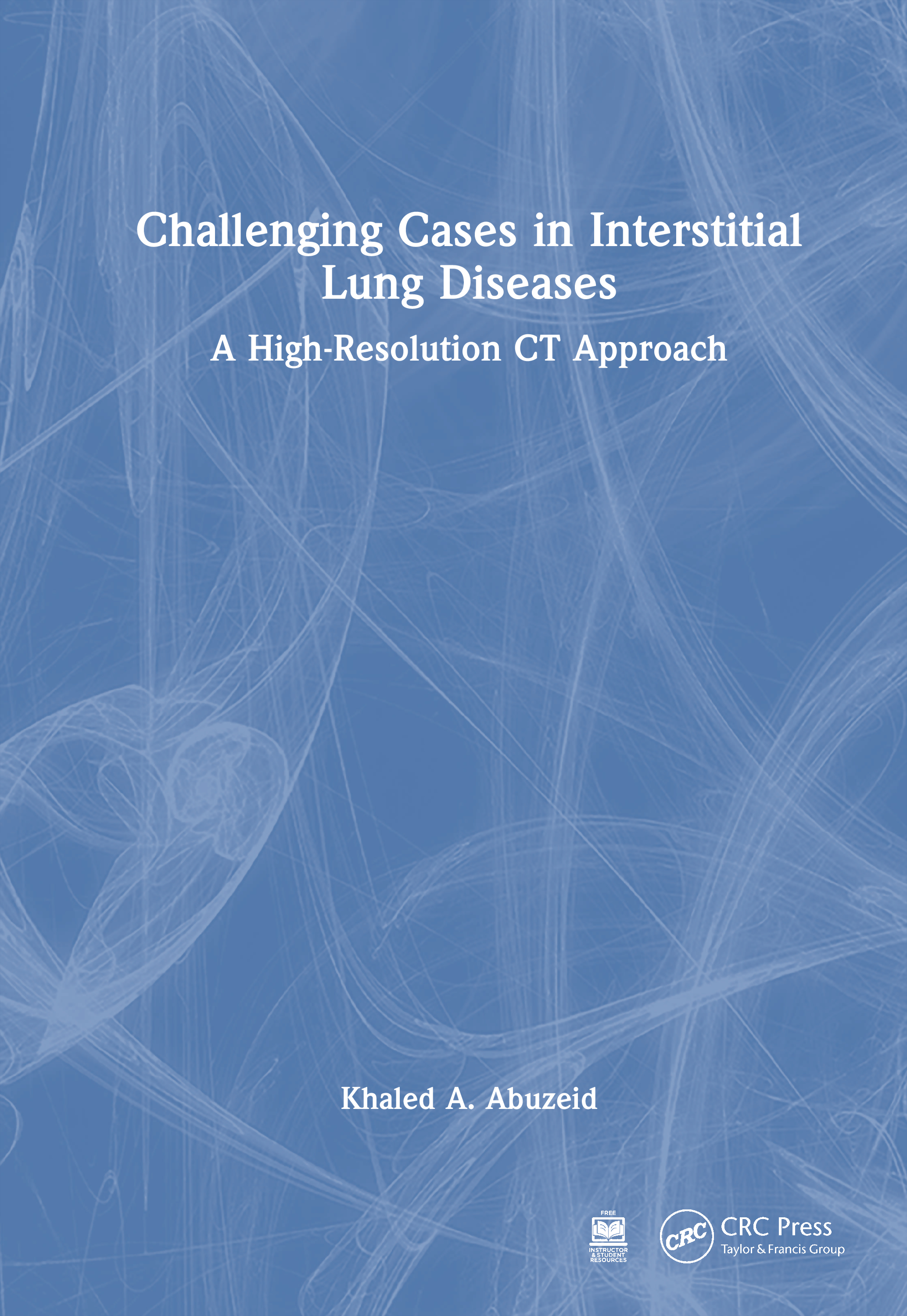 Challenging Cases in Interstitial Lung Diseases: A High-Resolution CT Approach(Challenging Cases)