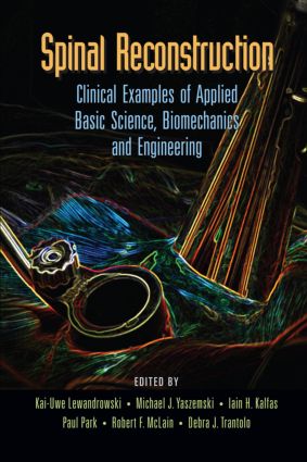 Spinal Reconstruction: Clinical Examples of Applied Basic Science, Biomechanics and Engineering(English)