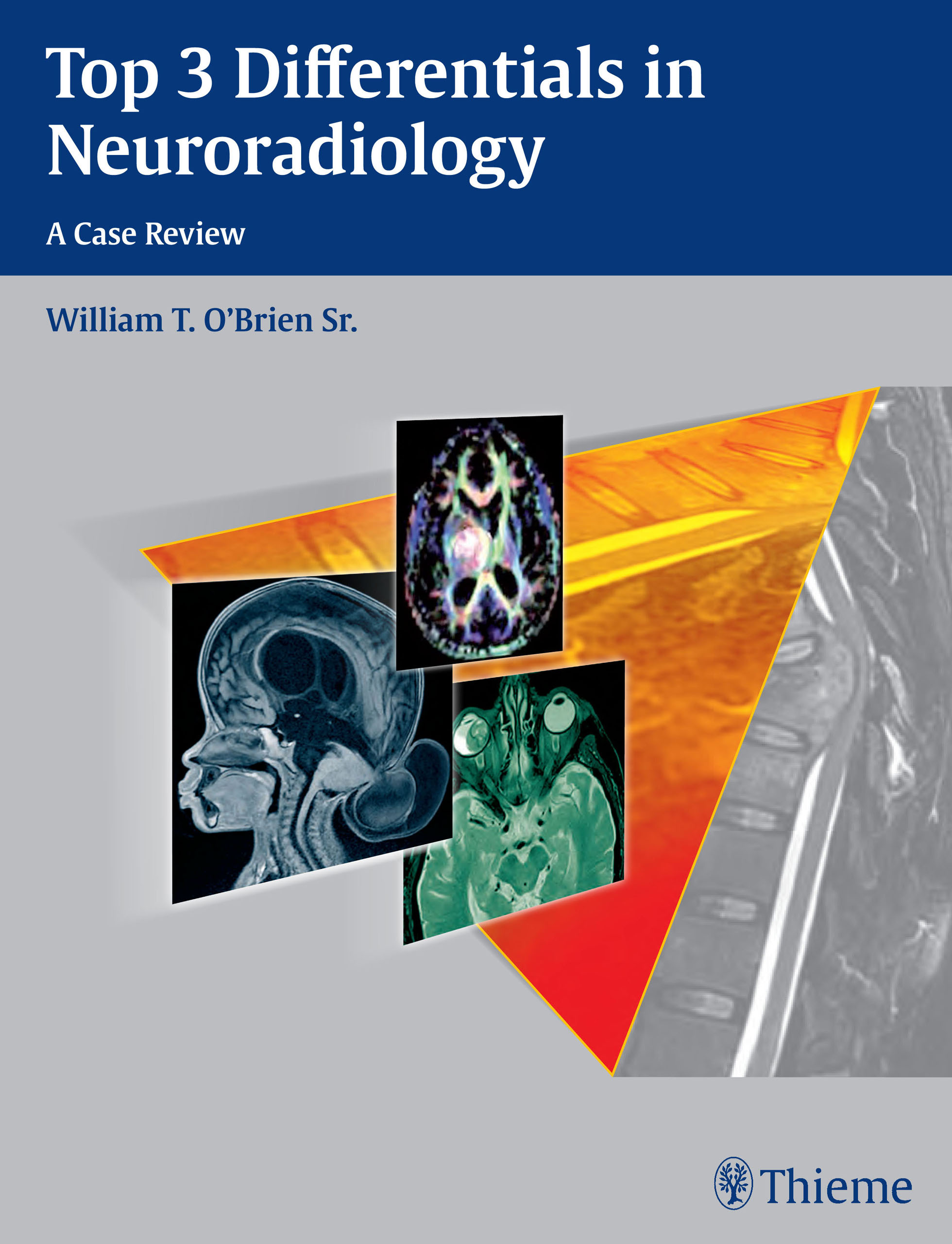 Top 3 Differentials in Neuroradiology: A Case Review(Top 3 Differentials)