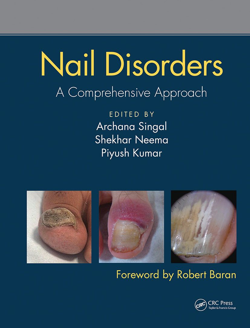 Nail Disorders: A Comprehensive Approach
