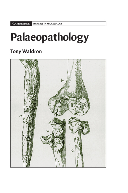 Palaeopathology: (Cambridge Manuals in Archaeology)