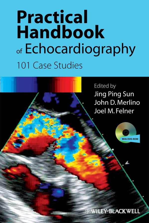 Practical Handbook of Echocardiography: 101 Case Studies(English)