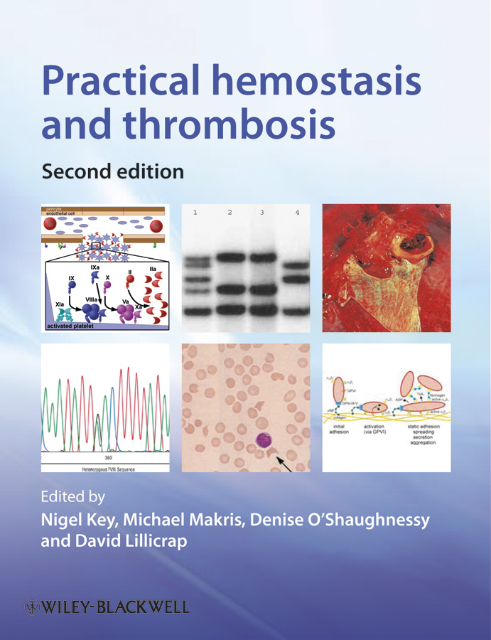 Practical Hemostasis and Thrombosis: (English)