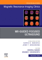MR-Guided Focused Ultrasound, An Issue of Magnetic Resonance Imaging Clinics of North America: Volume 32-4(Volume 32-4 The Clinics: Radiology)