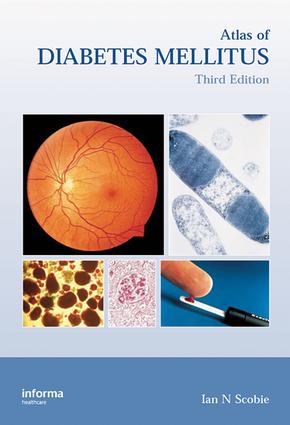 Recipients of the Padma Bhushan: A. P. J. Abdul Kalam, Purushottam Laxman Deshpande, Ravi Shankar, Amitabh Bachchan, R. K. Narayan, Aamir Khan