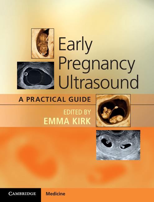 Early Pregnancy Ultrasound: A Practical Guide