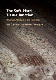 The Soft–Hard Tissue Junction: Structure, Mechanics and Function