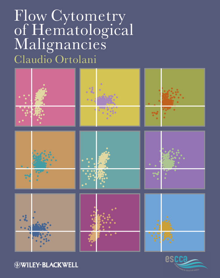 Flow Cytometry of Hematological Malignancies: (English)